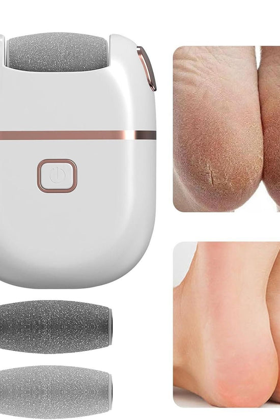 Electronic Pedicure Tool